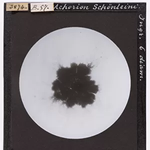 Microscopic enlargement of Achorion Schoenleinii, parasite fungus of man