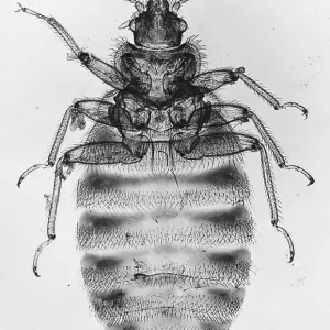 Light Micrograph Print of a Bedbug (Cimex lectularius)