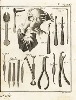 18th century lacrimal gland operation and surgical equipment 18th century lacrimal gland operation and surgical equipment