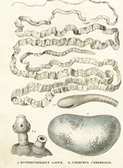 Spinal Gallery: Asian tapeworm and sheep tapeworm larva