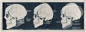 Comparison of British & German skull shapes, WW1 Comparison of British & German skull shapes, WW1