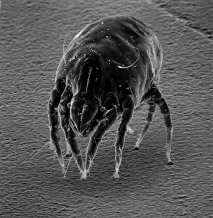 Dermatophagoides sp., dust mite Dermatophagoides sp., dust mite