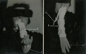 Investigation Gallery: Helen Duncan - Ectoplasm & Teleplasmic hand