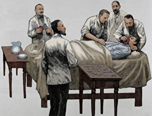 History of medicine. Chloroform anesthesia. Engraving, 19th History of medicine. Chloroform anesthesia. Engraving, 19th