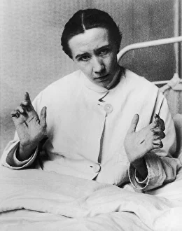 <b class=qtipBold><figcaption>Marasco Stigmata - 1</figcaption></b><br>BERTHA MRAZEK, also known as 'Georges Marasco' Belgian dual personality subject who displayed remarkable stigmata picture 1 of 3 - the hands<br><em>© Mary Evans Picture Library/HARRY</em> Marasco Stigmata - 1