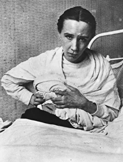<b class=qtipBold><figcaption>Marasco Stigmata - 3</figcaption></b><br>BERTHA MRAZEK, also known as 'Georges Marasco' Belgian dual personality subject who displayed remarkable stigmata picture 3 of 3 - on the body<br><em>© Mary Evans Picture Library 2015 - https://copyrighthub.org/s0/hub1/creation/maryevans/MaryEvansPictureID/10028035</em> Marasco Stigmata - 3