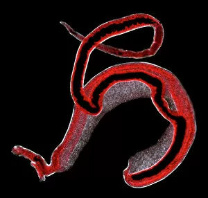 Invertebrata Gallery: Schistosoma spp. blood flukes
