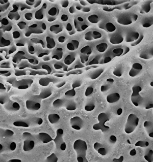 SEM of echinoderm steroem SEM of echinoderm steroem
