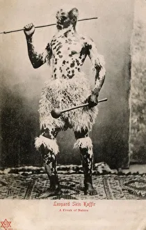A South African Man with skin pigmentation condition A South African Man with skin pigmentation condition