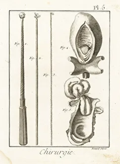 Surgical instruments to remove foreign bodies Surgical instruments to remove foreign bodies