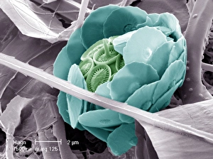 Protista Gallery: Syracosphaera anthos
