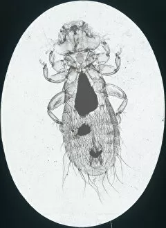 Louse Gallery: X-Ray - Microscopic x-ray view of a small head louse