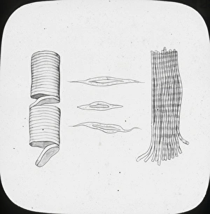 X-Ray - Voluntary and Involuntary Muscular Fibres X-Ray - Voluntary and Involuntary Muscular Fibres