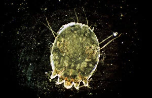 Condition Gallery: Dark Field Light Micrograph: Scabies Mite
