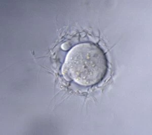 Light Micrograph of Mouse Ovum being fertilized
