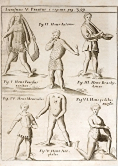 1662 Schott deformities real and imagined 1662 Schott deformities real and imagined