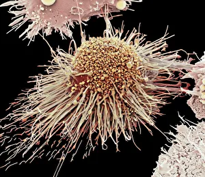 Immunology Gallery: Activated macrophage, SEM C015 / 6375