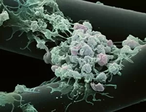Images Dated 13th February 2002: Activated platelets, SEM