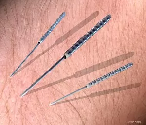 Images Dated 1st May 2001: Acupuncture needles