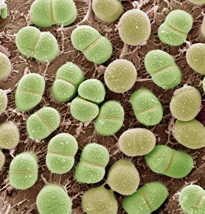 Coloured Scanning Electron Micrographs Prints: Algae, SEM