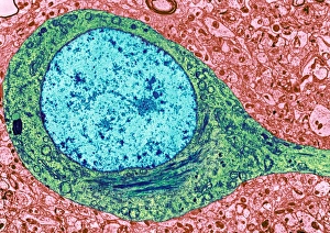 Cell Body Gallery: Alzheimers disease brain cell, TEM