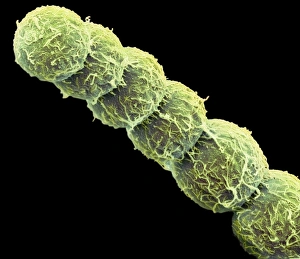 Anabaena algae, SEM