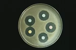 Cultured Gallery: Anthrax antibiotics research