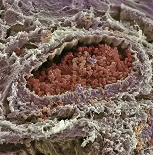 Images Dated 9th October 2003: Artery SEM