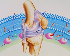 Artwork of arthritic knee and NSAID drug mechanism Artwork of arthritic knee and NSAID drug mechanism