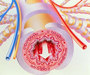 Artwork of bronchodilator drug in bronchiole Artwork of bronchodilator drug in bronchiole