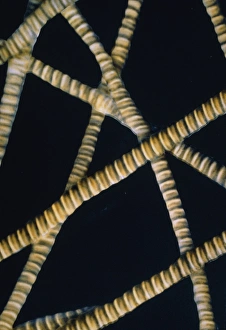 Artwork of collagen fibres in connective tissue Artwork of collagen fibres in connective tissue