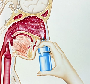 Artwork of nasal spray being used in hay fever Artwork of nasal spray being used in hay fever