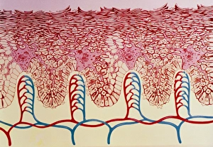 Artwork of a section through sunburnt skin Artwork of a section through sunburnt skin