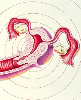 Images Dated 12th March 2003: Artwork of uterus suffering menstrual pain