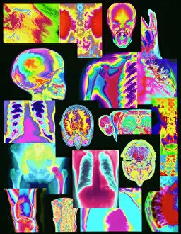 Assortment Gallery: Assortment of coloured X-rays and body scans