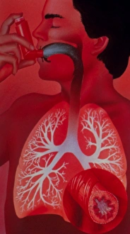 Asthma inhaler use Asthma inhaler use