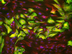 Nuclei Gallery: Astrocyte brain cells, light micrograph
