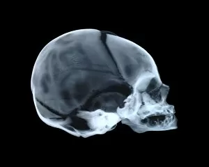 Babys skull
