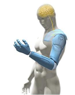 Robotic Gallery: Bionic arm, artwork