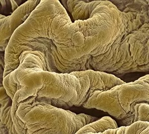 Images Dated 1st May 2003: Bladder lining, SEM