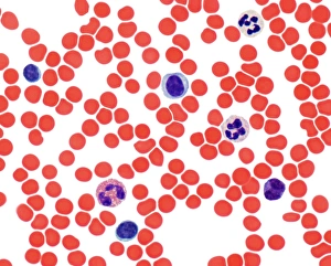 Blood smear, light micrograph F005/6090 Blood smear, light micrograph F005/6090