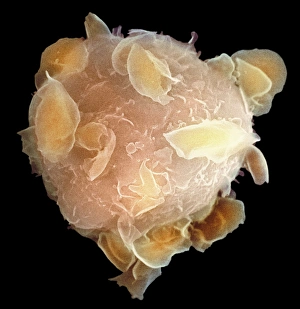 Stem Cell Gallery: Bone marrow stem cell, SEM