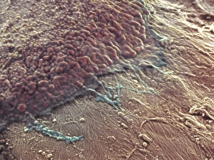Bone reabsorption, SEM Bone reabsorption, SEM