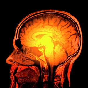 Nervous System Gallery: Brain anatomy, MRI scan