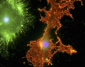 Confocal Gallery: Brain cells in culture, light micrograph
