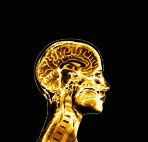 Brain Brain
