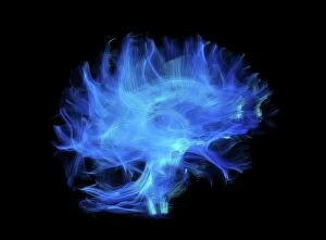 Central Nervous System Gallery: Brain fibres, DTI MRI scan C017 / 7035