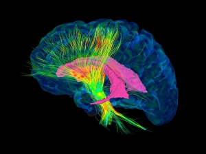 Central Nervous System Gallery: Brain fibres, DTI MRI scan C017 / 7036