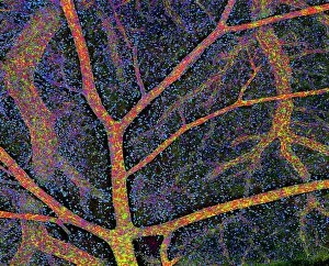 Light Micrograph Gallery: Brain tissue blood supply