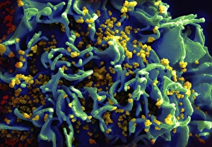 Budding HIV particles, SEM C018/8599 Budding HIV particles, SEM C018/8599